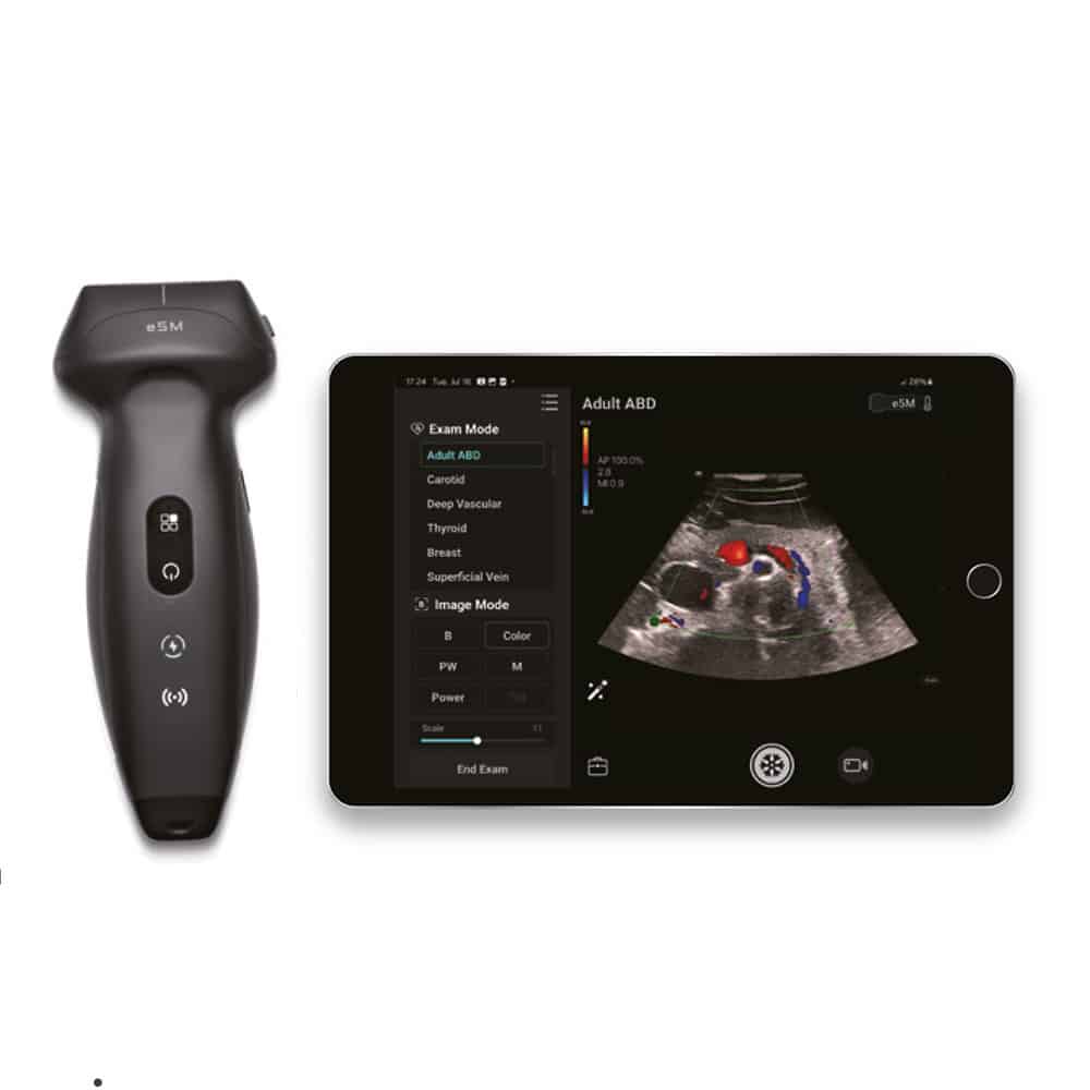 Ecografo portatile-mindray TE